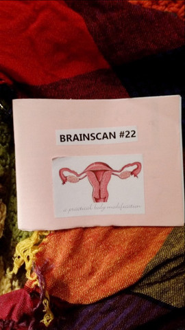 Brainscan #22: A Practical Body Modification