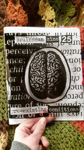 Brainscan #25
